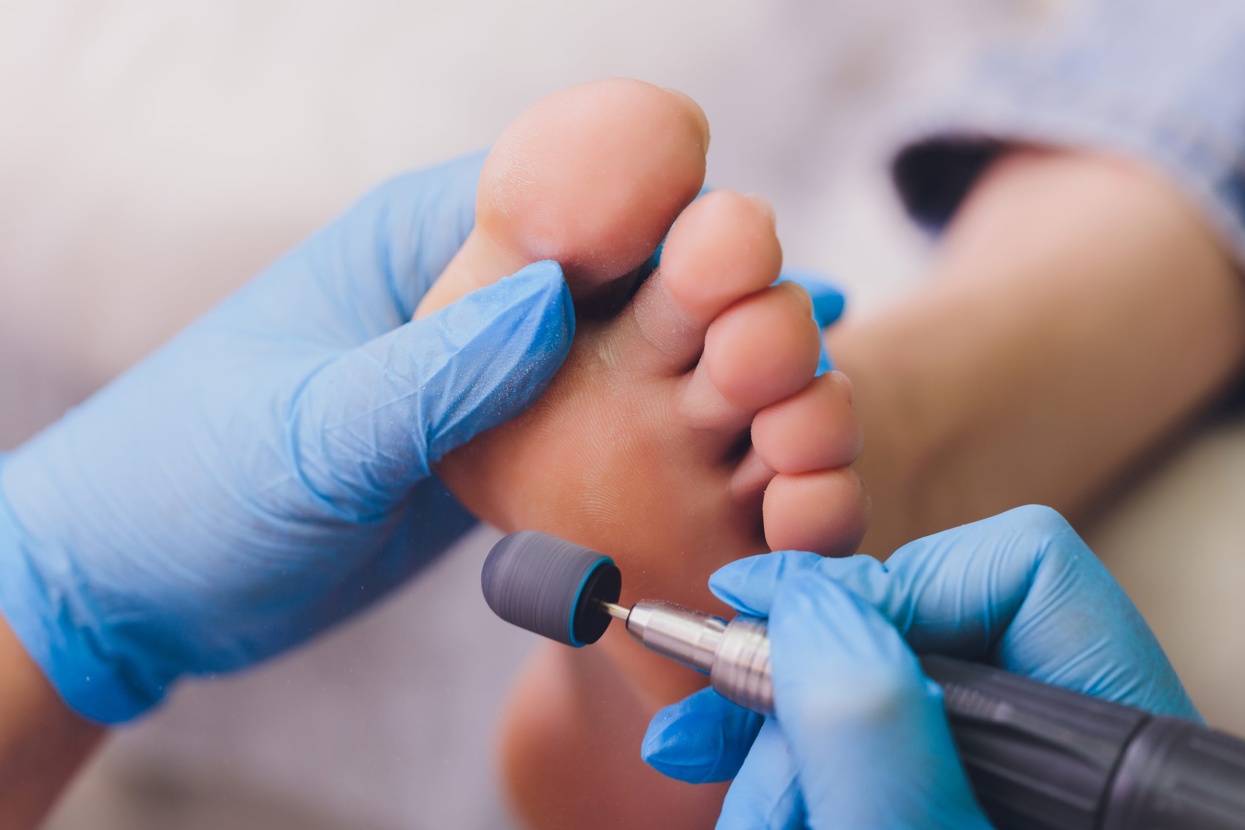 ציונה טוך המרכז לשיקום ובריאות כף הרגל וקוסמטיקאית פרא רפואית